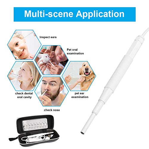 USB Otoscope, 3.9mm Ultra-Thin Digital Otoscope Camera, 720P Ear Inspection Endoscope Visual Ear Scope Cleaner with Ear Wax Remover Cleaning Tool and 6 Adjustable LED Light for Android, Windows, Mac