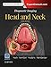 Diagnostic Imaging: Head and Neck E-Book