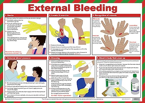 External Bleeding
