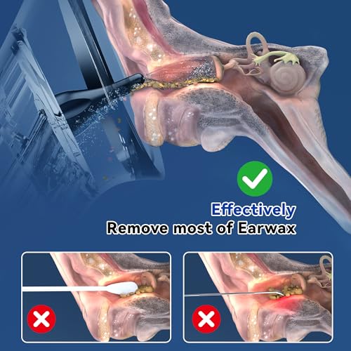 Upgraded Electric Ear Wax Removal Kit - Water Temperature Sensor & One-Piece Waste Tank - Ear Wax Cleaner with 4 Modes IPX7 Ear Irrigation Flushing System with 10 Tips