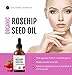 Rosehip Seed Oil by Kate Blanc. USDA Certified Organic, 100% Pure, Cold Pressed, Unrefined. Reduce Acne Scars. Essential Oil for Face, Nails, Hair, Skin. Therapeutic AAA+ Grade (1 oz)thumb 1
