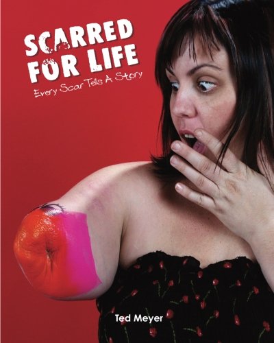Scarred for Life: Every Scar Tells a Story