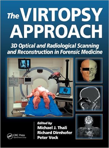 The Virtopsy Approach 3d Optical And Radiological Scanning And Reconstruction In Forensic Medicine 1 J Michael M D Thali Michael Thali Richard Dirnhofer Peter Vock Amazon Com