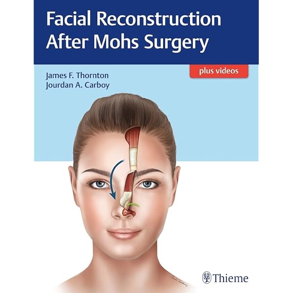 Local Flaps in Facial Reconstruction: 9780323683906: Medicine