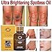 4pcs Ultra Brightening Spotless Oil 30mL, Remove Acne Scars Burn Stretch Marks Skin Care Oil Brightening Skin Essence Oil