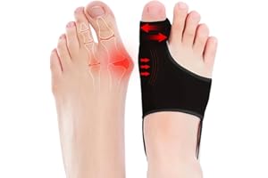 WERNOKLE 1 Pair Bunion Corrector for Women & Men,Big Toe Separators-Bunion Splint-Bunion Pads-Hammer Toes Straightener-Toes Spacers Pain Relief, Comfortable & Breathable for Day/Night（Black）
