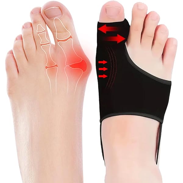 Bunion Relief Corrector Pad - Gel Toe Separators & Sleeves For Hallux Valgus, Foot Pain, And Toe Alignment, Size S - View #6