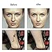 Mole Wart Spot Removal Pen, Electric Body Facial Skin Freckle Dot Blemish Skin Tag Remover Home Kit, Portable USB Chargeable Beauty Pen (White)