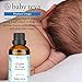 Cradle Cap Oil Treatment - Infant & Baby Remedy | Natural, Soothing, and Nourishing Dry Scalp Oil, by Baby Teva