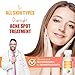 Ebanel Acne Spot Drying Lotion for Face & Body with Sulfur & Salicylic Acid, Targets Pimples & Zits, Helps Clear Pores and Reduce Surface Blemishes Overnight