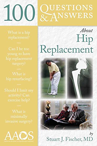 100 Questions & Answers About Hip Replacement - Thumbnail 4