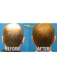 Suplemento de vitaminas para el crecimiento del cabello. Apoyo 100 % natural para cabello más largo y fuerte con biotina, vitamina A, bambú, vitamina D y más