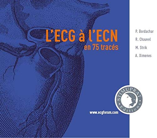 L'ECG à l'ECN by Pierre Bordachar (Paperback)