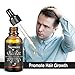 Skymore 30ml Fast Hair Growth Serum, Anti-Hair Loss, Hair Thinning Treatment, 100% Pure & Natural, Non-Greasy, Nourishing & Moisturizing, All Hair Types