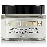 Best Dark Spot Corrector & Natural Skin Whitening Fade Cream, A+ Lightening Blemish Removal Serum Reduces Age Spots, Freckles, Melasma & Hyperpigmentation - Get Rid Of Liver Spots & Skin Discoloration