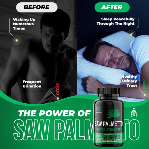 Saw Palmetto DHT Blocker Supplement Support Prostate Health & Prevent