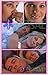 Anti Snoring aid, NasalVent MEDIC. Snore Free aid. New 5 Sizes for Easy Breathing.