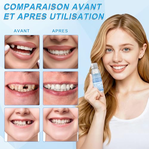 Temporary Dental Filler(2PCS) Dental Filler Repair Kit, Denture Repair Beads for Temporary Fixing