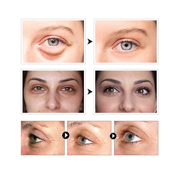 Under-Eye-Mask-Collagen-Eye-Mask-Under-Eye-Patches-Eye-Pads-Anti-Aging-Eye-Patches-with-Collagen-For-Brightens-Reducing-Wrinkles-Dark-Circles-Eye-Bags-and-Puffiness30-Pairs Under Eye Mask, Collagen Eye Mask, Under Eye Patches, Eye Pads, Anti Aging Eye Patches with Collagen, For Brightens…