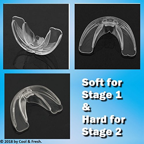 2 High+tech+Dental+Orthodontic+Braces+Straightening