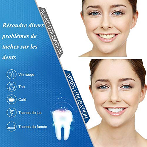 ISUDA Kit Blanchiment Dentaire, 10*Gel de Blanchiment des Dents, 1*LED Lampe, 2*Plateau Dentaire, Blanchiment Dentaire Professionnel et à Domicile, pour Taches de Fumée, Dents noires, Soin des Dents