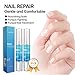 Aliceva Nail Fungus Stop - Anti-Fungal Nail Pen Against Discoloration, Brittle and Cracked Nails - 2PCS