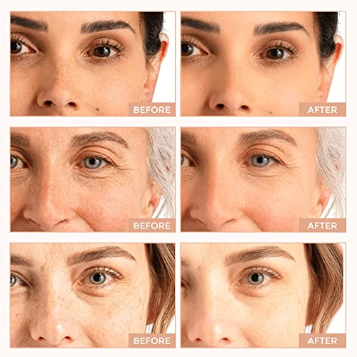 Retinol Serum for Face, B5 Herbal Resurfacing Retinol Serum with Vitamin C, Vitamin E, Hyaluronic Acid, Serum for Anti-Aging, Wrinkle Smoothing, Dark Spot Corrector, Brighten Dullness