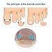 Anself 12Pcs Ingrown Toenail Correction Wire Fixer Toe Nail Corrector Pedicure Treatment Foot Care Tool