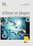 Sclérose en plaques by