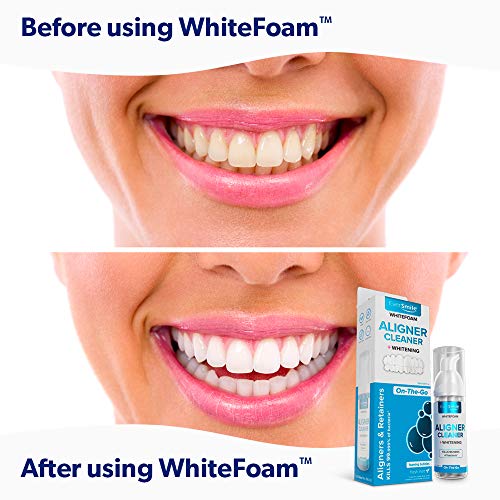 WhiteFoam OntheGo Clear Retainer Cleaner for Invisalign, Dentures