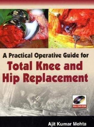 A PRACTICAL OPERATIVE GUIDE FOR TOTAL KNEE AND HIP REPLACEMENT