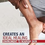 Aquaphor Healing Ointment Skin Protection 14oz Dermatologist Recommended Dry view 11