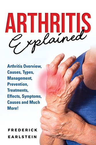 B.O.O.K Arthritis Explained: Arthritis Overview, Causes, Types, Management, Prevention, Treatments, Effects,<br />D.O.C