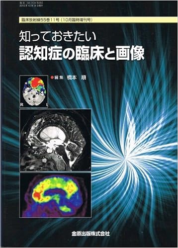 臨床放射線 Vol 55 No 11 10月増刊号 知っておきたい認知症の臨床と画像 金原出版株式会社 本 通販 Amazon