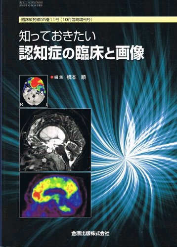 臨床放射線 Vol 55 No 11 10月増刊号 知っておきたい認知症の臨床と画像 金原出版株式会社 本 通販 Amazon