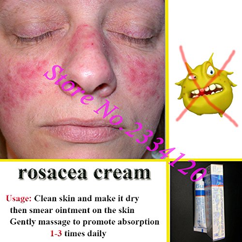 creams to treat rosacea