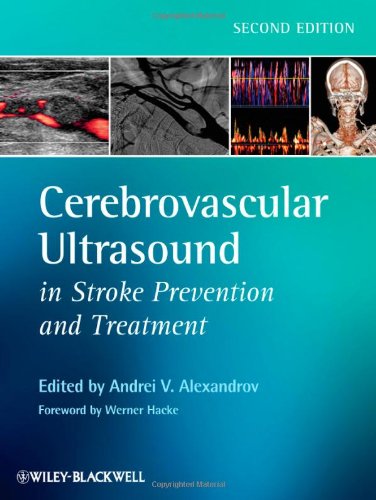 Cerebrovascular Ultrasound in Stroke Prevention and Treatment 2e