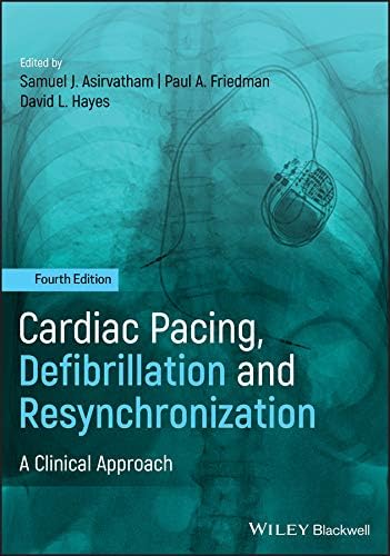 Amazon.com: The EHRA Book of Interventional Electrophysiology