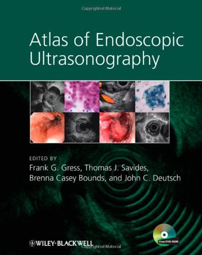 Atlas of Endoscopic Ultrasonography + DVD