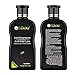 Hair Growth Stimulating Shampoo, Anti-Hair Loss Hair Shampoo, Thinning Hair Treatment - For men & women, 200ML