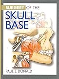 Facial, Plastic and Reconstructive Surgery : Surgery of the Face and Neck, Donald, Paul J., 0397512899