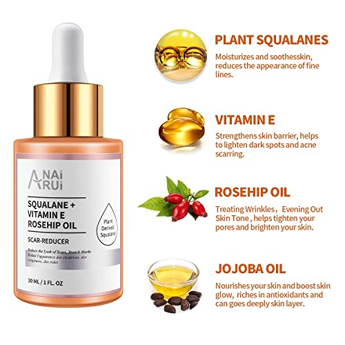 ANAI RUI Squalane + Vitamin E Rosehip Oil Moisturizer for Face Hydrate