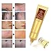 TCM Scar Cream-Acne Scar Removal Cream-Skin Repair Scars Burns Cuts Pregnancy Stretch Marks-Acne Spots Acne Treatment Blackhead Whitening Cream Stretch Marks for Body