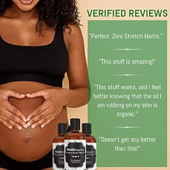 target stretch mark oil