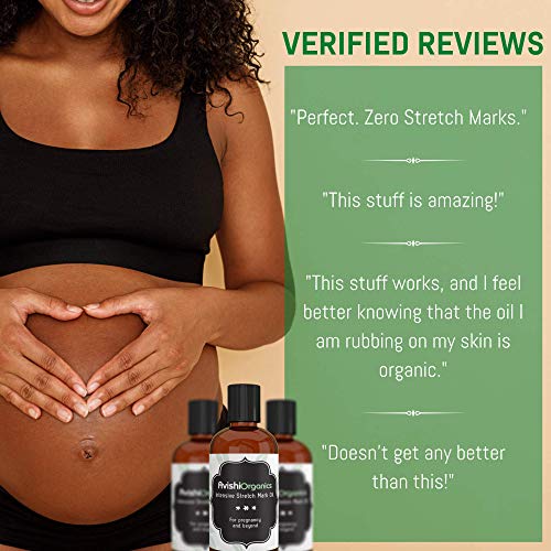 stuff for stretch marks