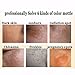 2 Pcs Chinese Face Whitening Cream, Anti Freckle Melasma, Lightening Pigment Brighten Skin Tone Skin Care