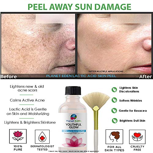 Intense Repair 88% Lactic Acid Skin Peel with Free Fan Brush - Unbuffered Professional Grade - Revive Sun Damaged Skin Quickly - Thumbnail 2