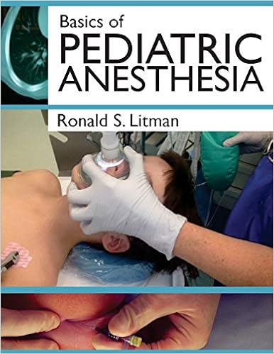 Basics Of Pediatric Anesthesia Print Edition 9781530122745 - 