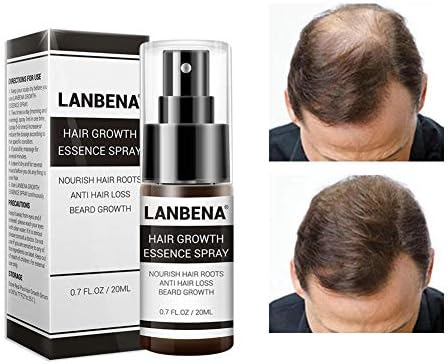 Ablerfly Hair Serum, Anti Hair Loss, Hair Growth Serum Essence Spray Hair Care Oil herbal hair growth product for hair-loss, alopecia areata alopecia totalis