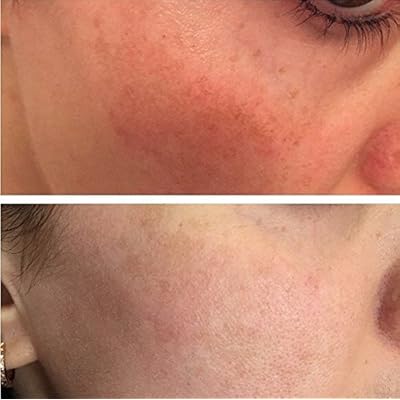 skinkissed serum amazon